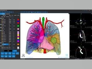 মেডিকেল 3D পুনর্নির্মাণ এবং 3D মুদ্রণ পরিষেবা